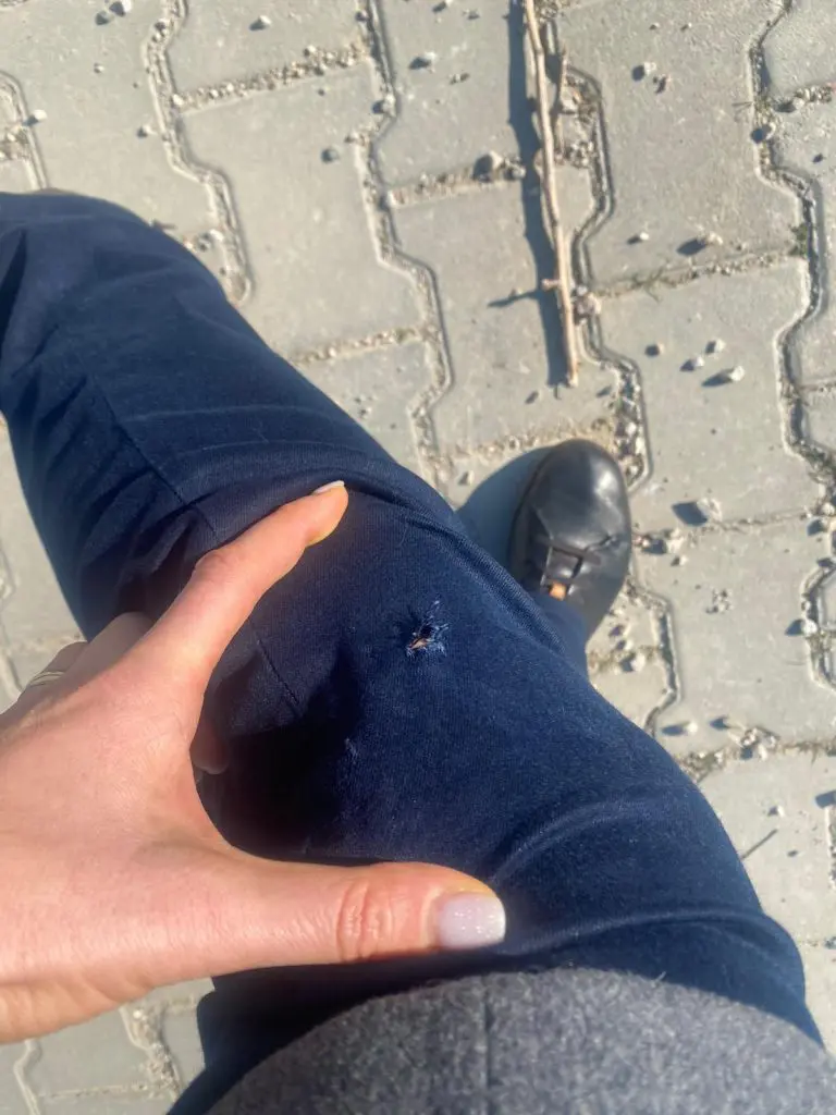 Seferihisar’da köpek saldırısı: 1 kişi yaralandı